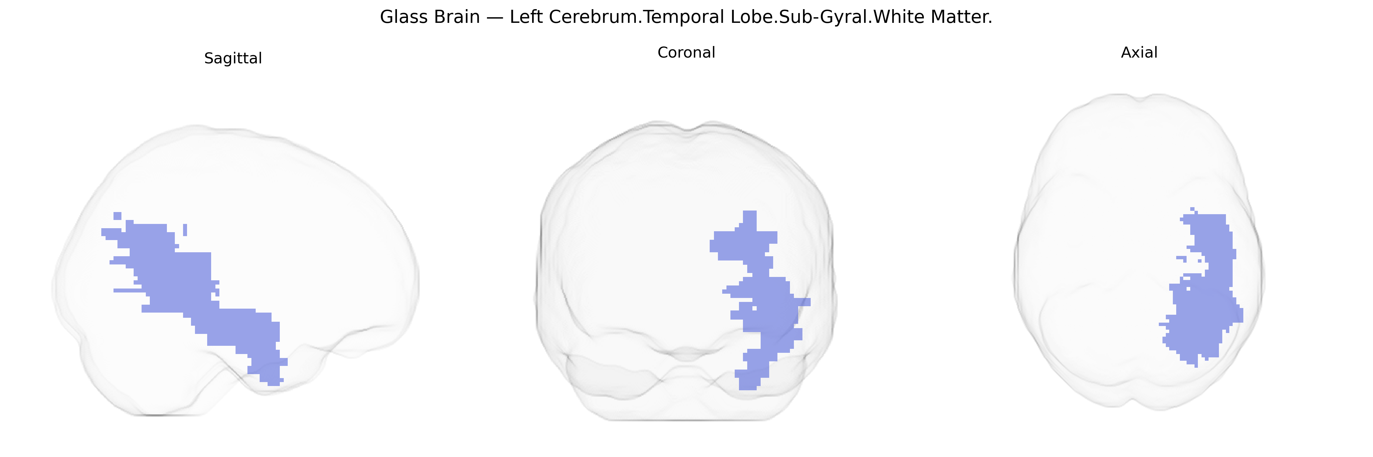 Triplanar Ghost Brain
