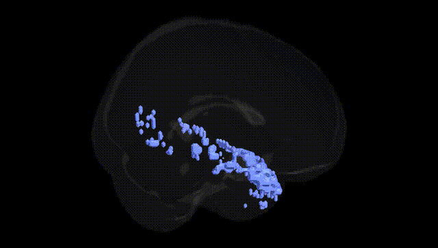 Full Brain Black