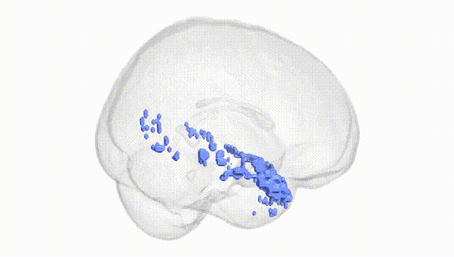 Full Brain White