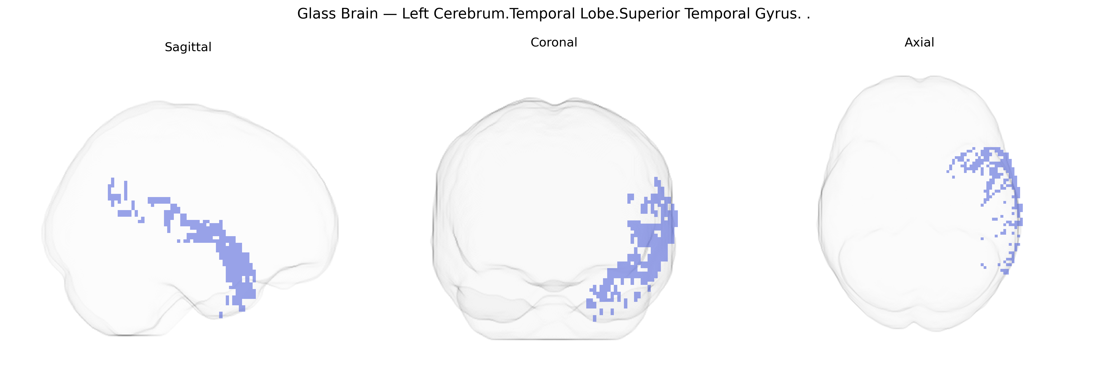 Triplanar Ghost Brain