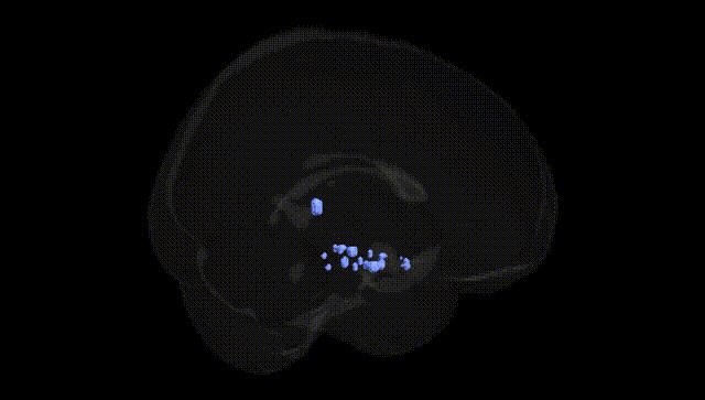 Full Brain Black
