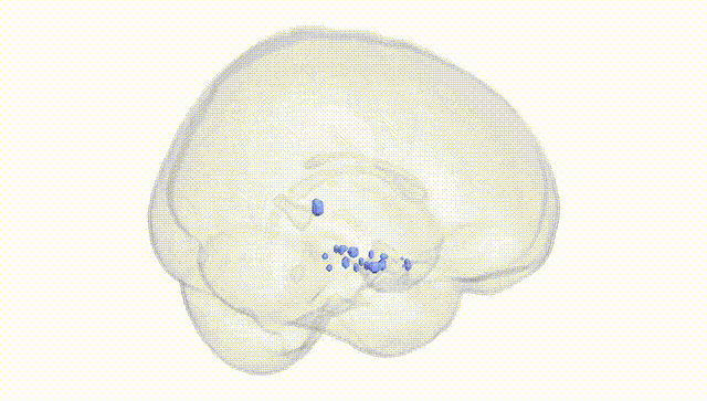 Full Brain White
