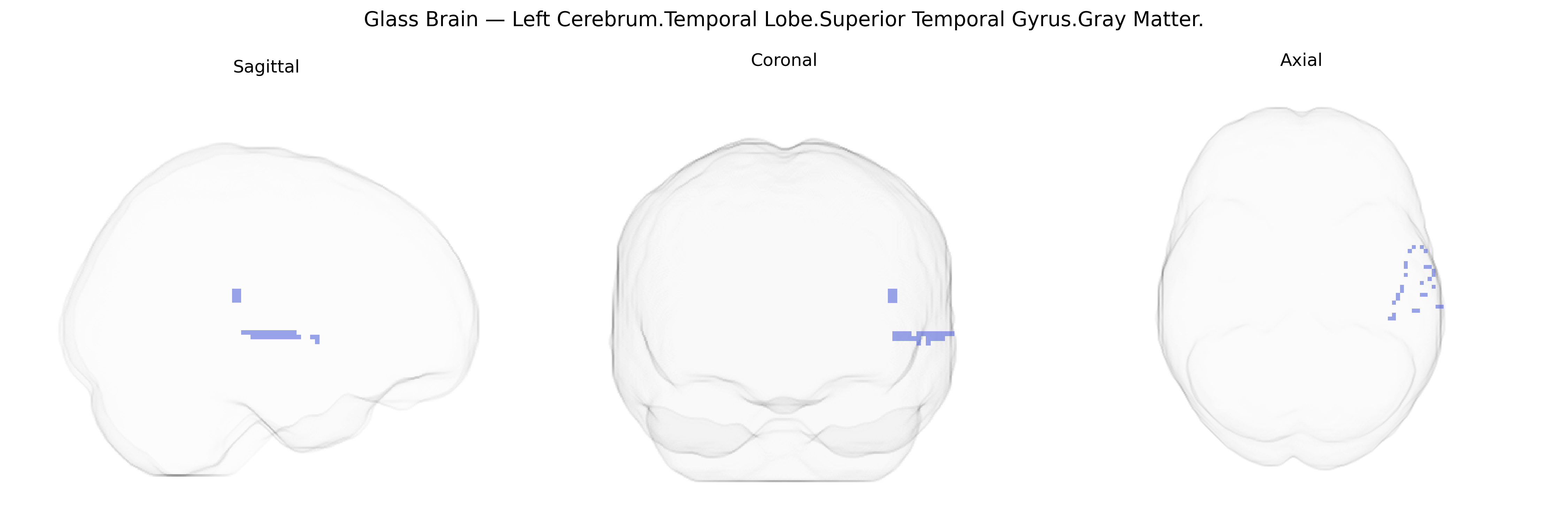 Triplanar Ghost Brain