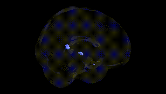 Full Brain Black