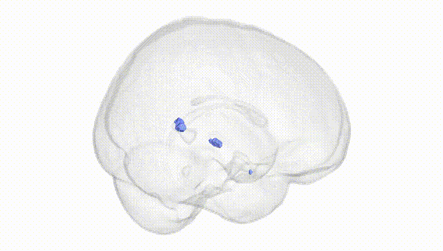 Full Brain White