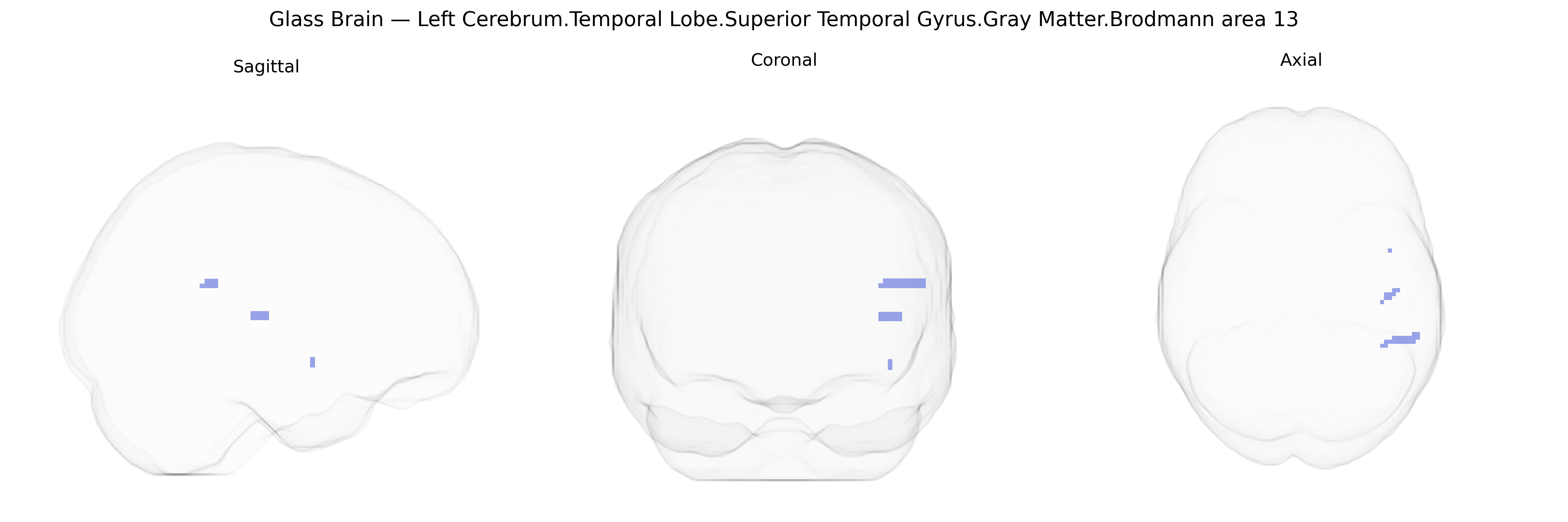 Triplanar Ghost Brain