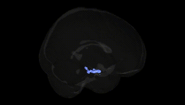 Full Brain Black