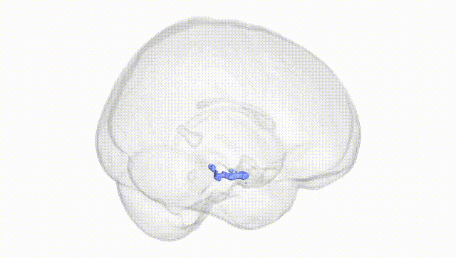 Full Brain White