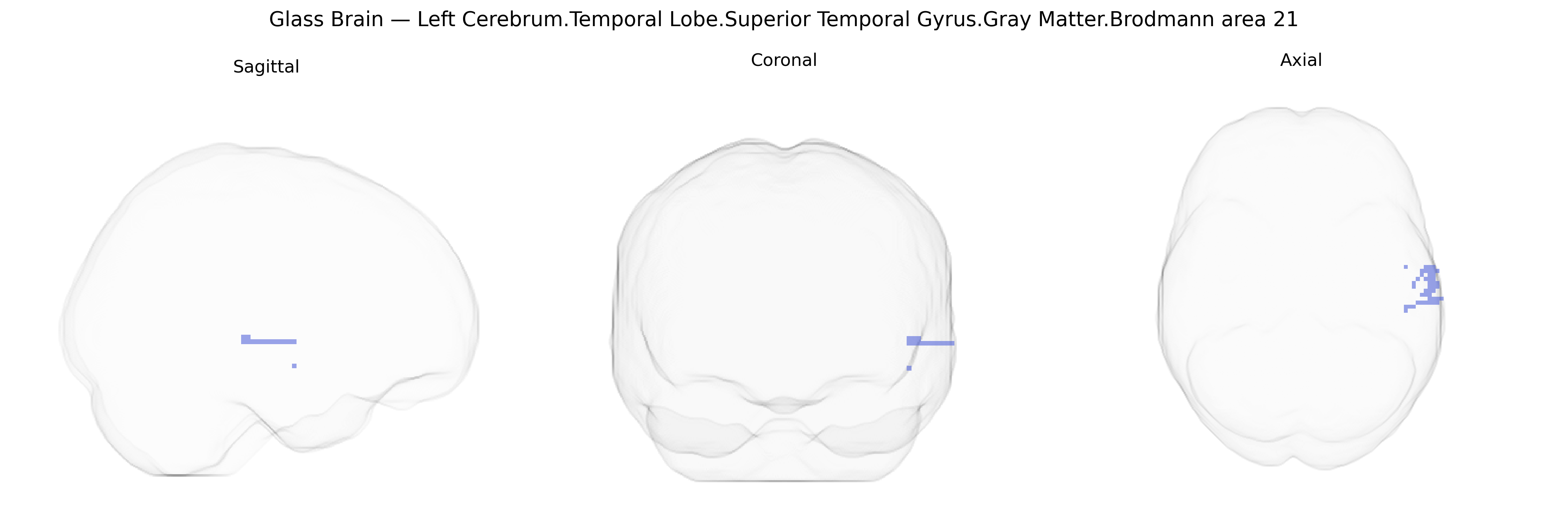 Triplanar Ghost Brain