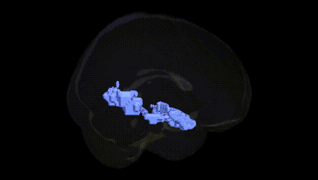 Full Brain Black