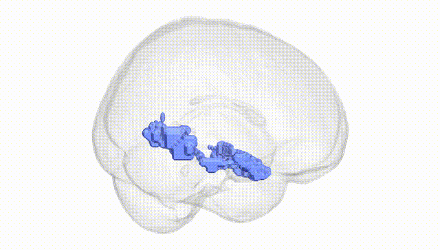 Full Brain White