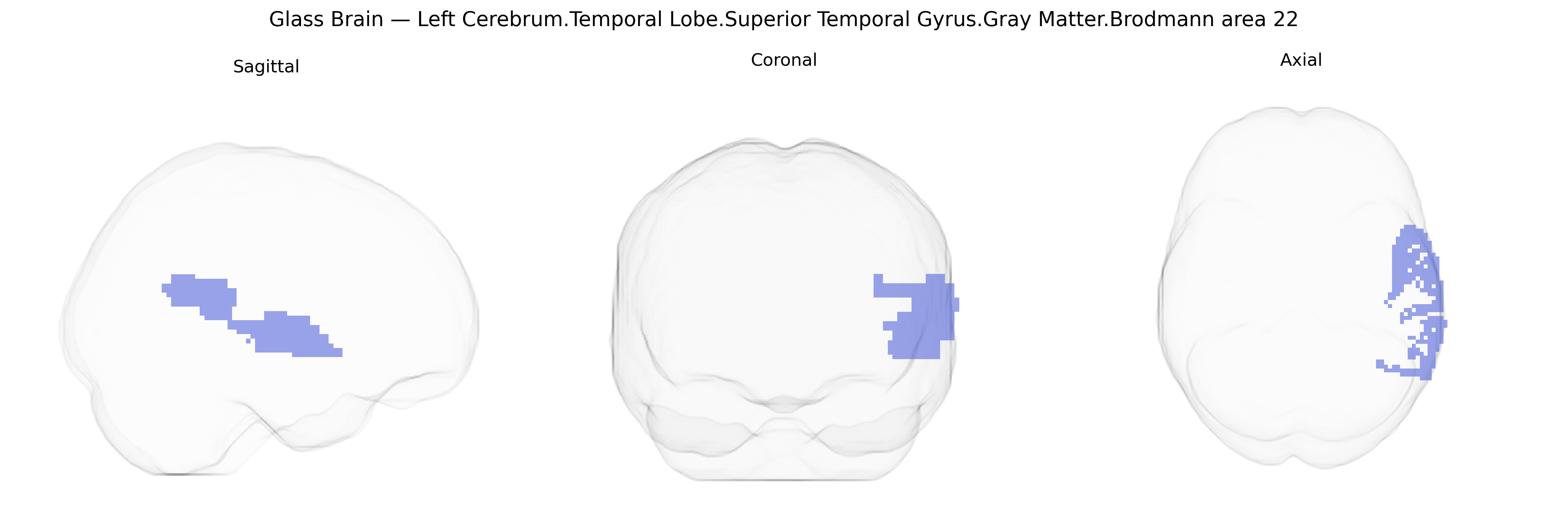 Triplanar Ghost Brain