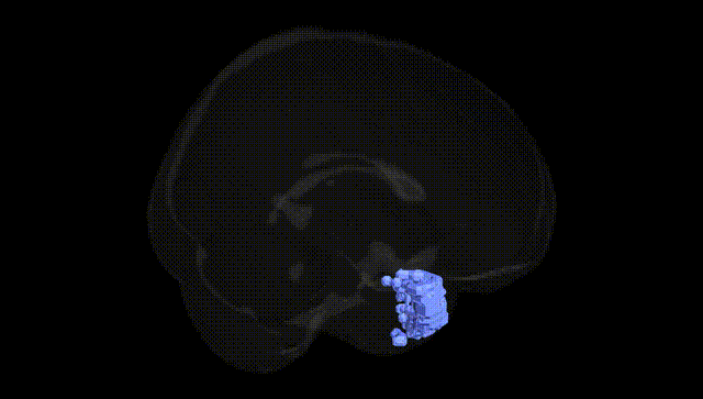 Full Brain Black
