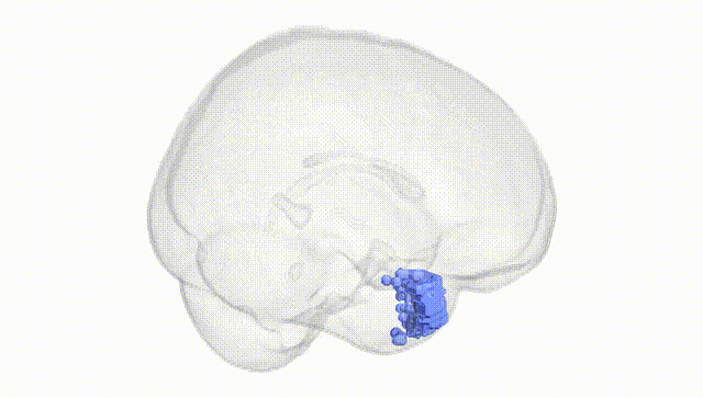 Full Brain White