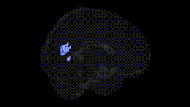 Full Brain Black