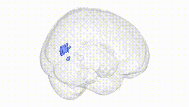 Full Brain White
