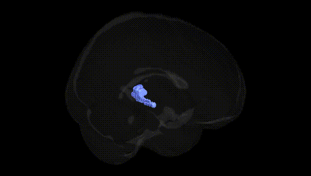Full Brain Black