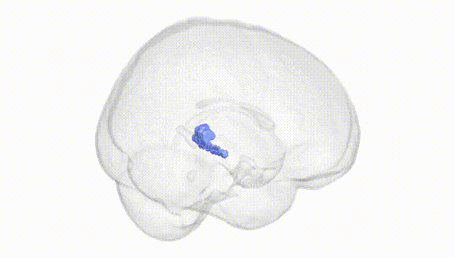 Full Brain White