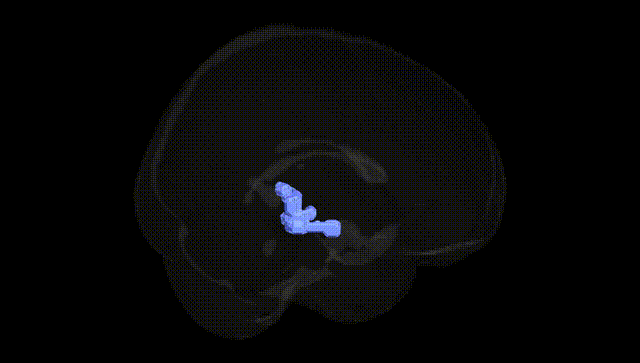Full Brain Black