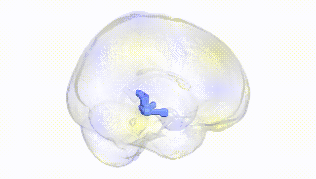 Full Brain White