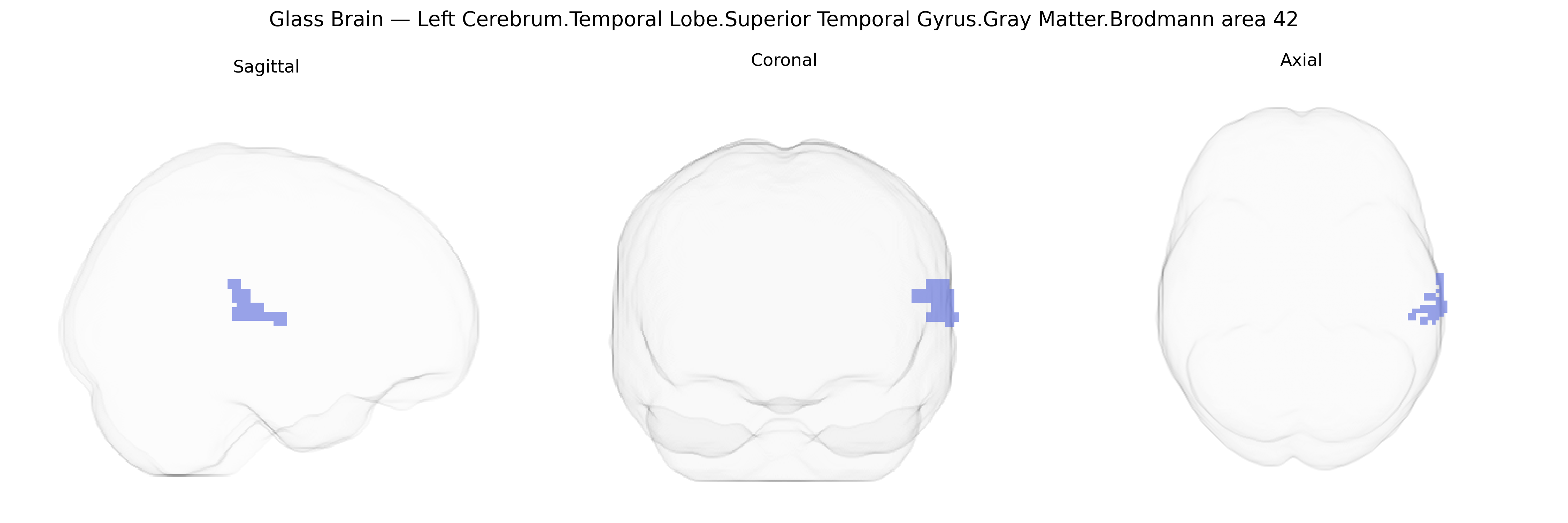 Triplanar Ghost Brain