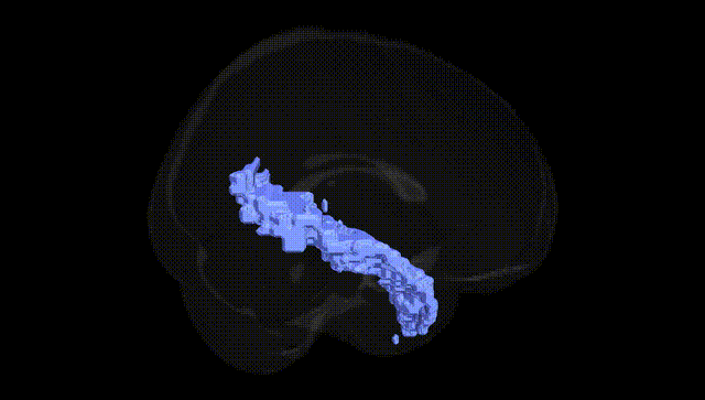 Full Brain Black