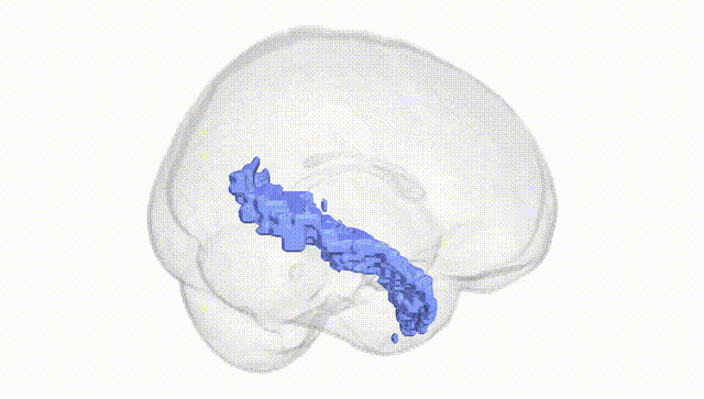 Full Brain White