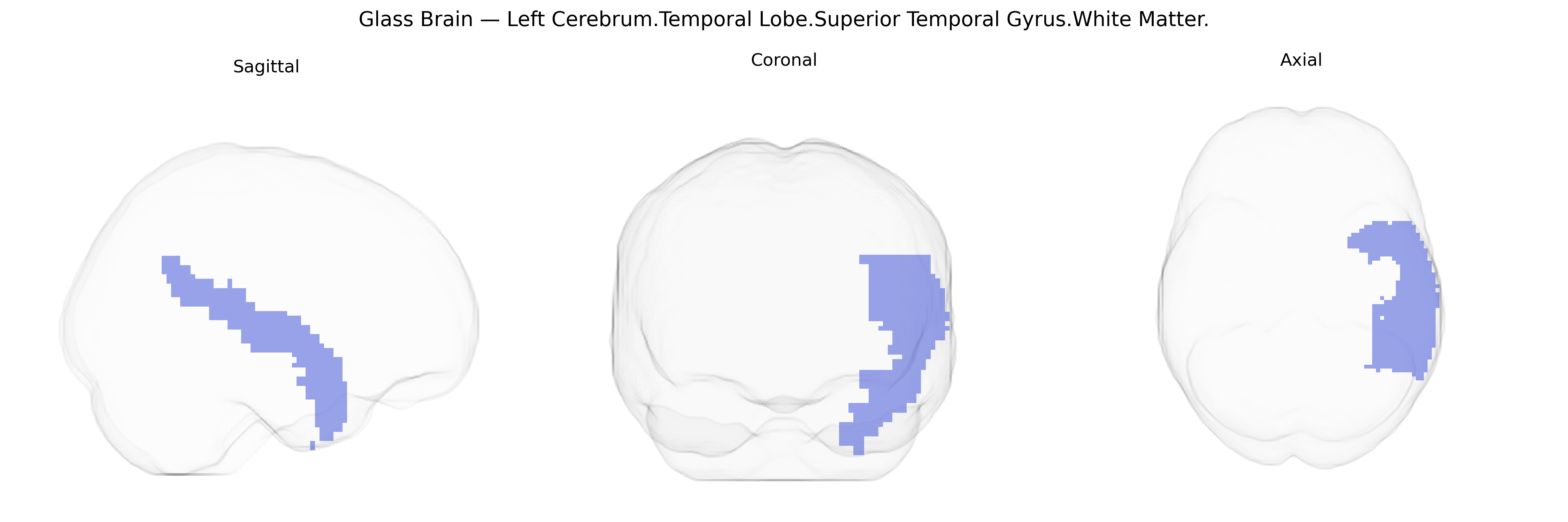 Triplanar Ghost Brain