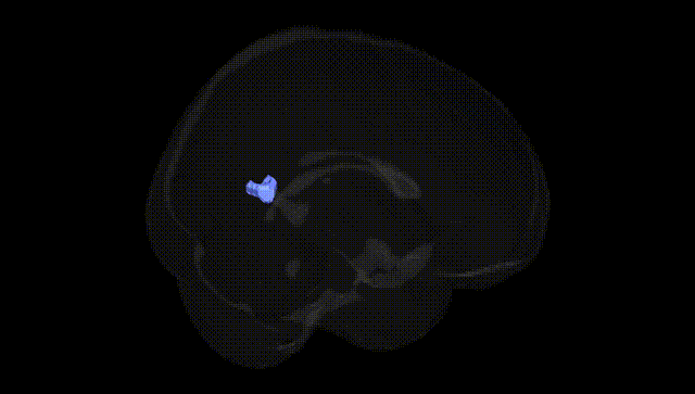 Full Brain Black