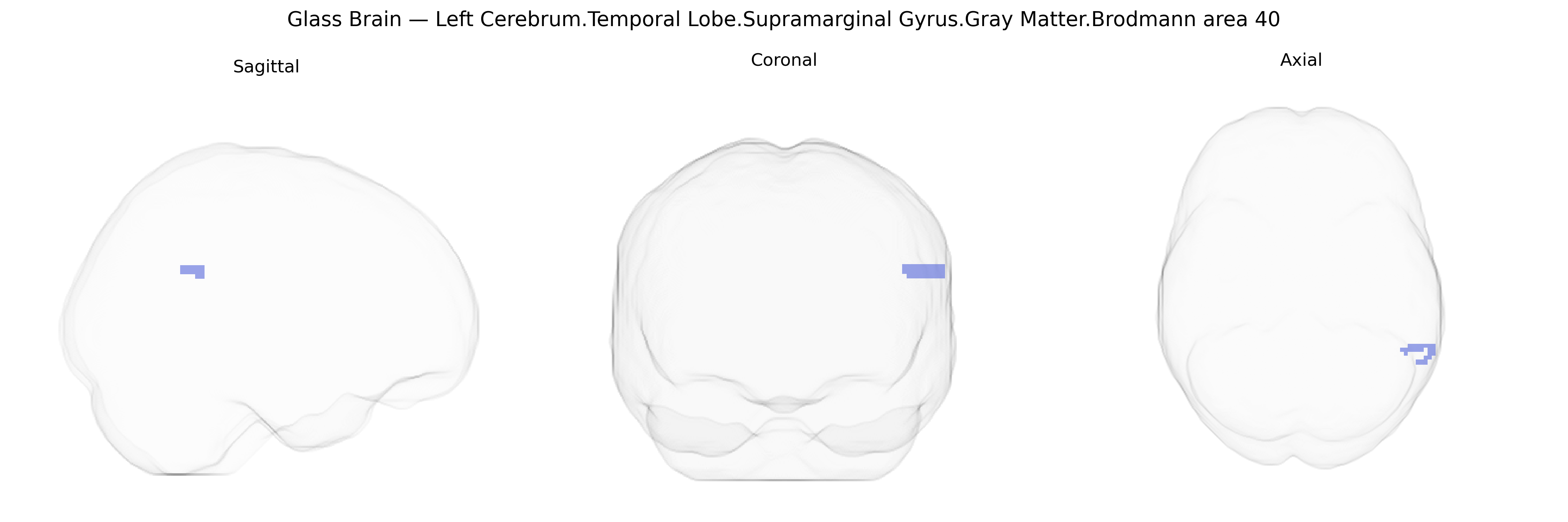 Triplanar Ghost Brain
