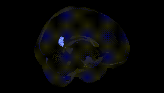 Full Brain Black