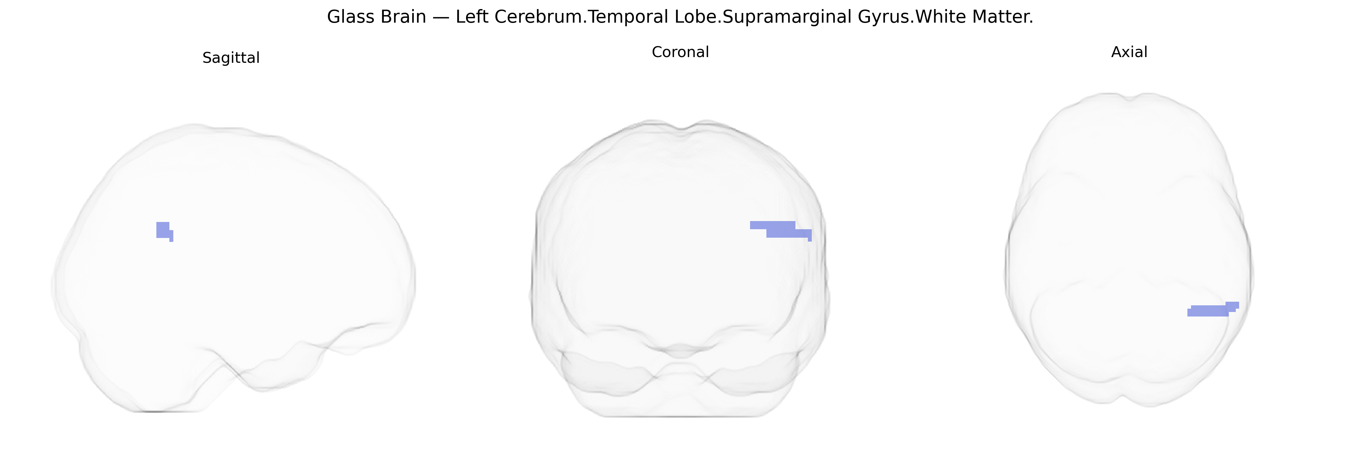 Triplanar Ghost Brain