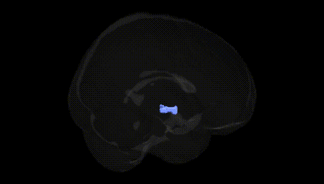 Full Brain Black