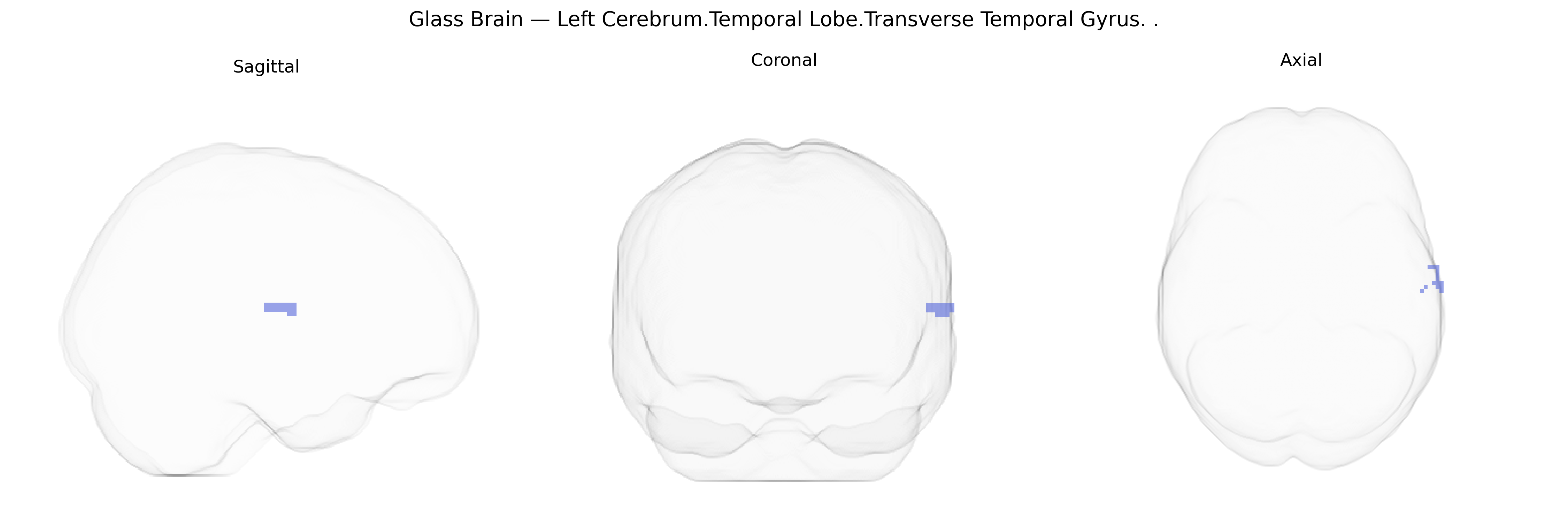 Triplanar Ghost Brain