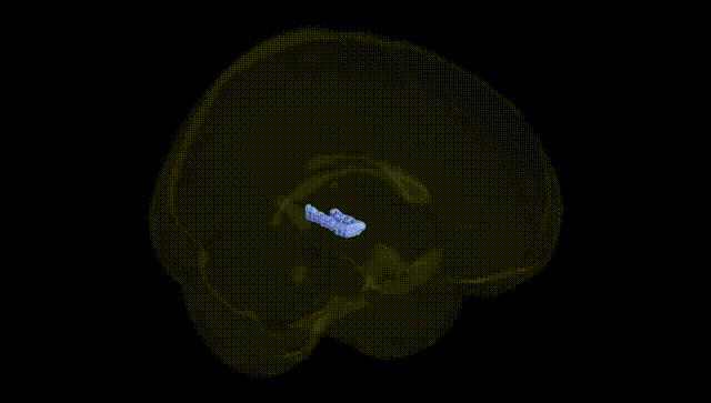 Full Brain Black