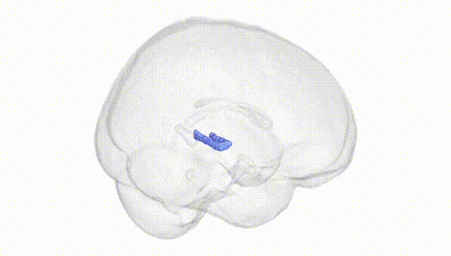 Full Brain White