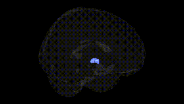 Full Brain Black