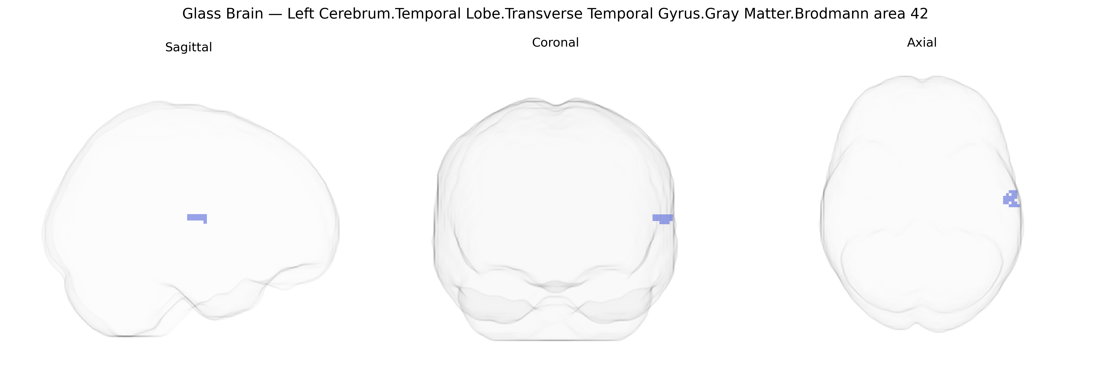 Triplanar Ghost Brain
