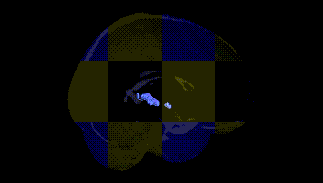 Full Brain Black