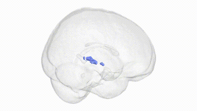 Full Brain White