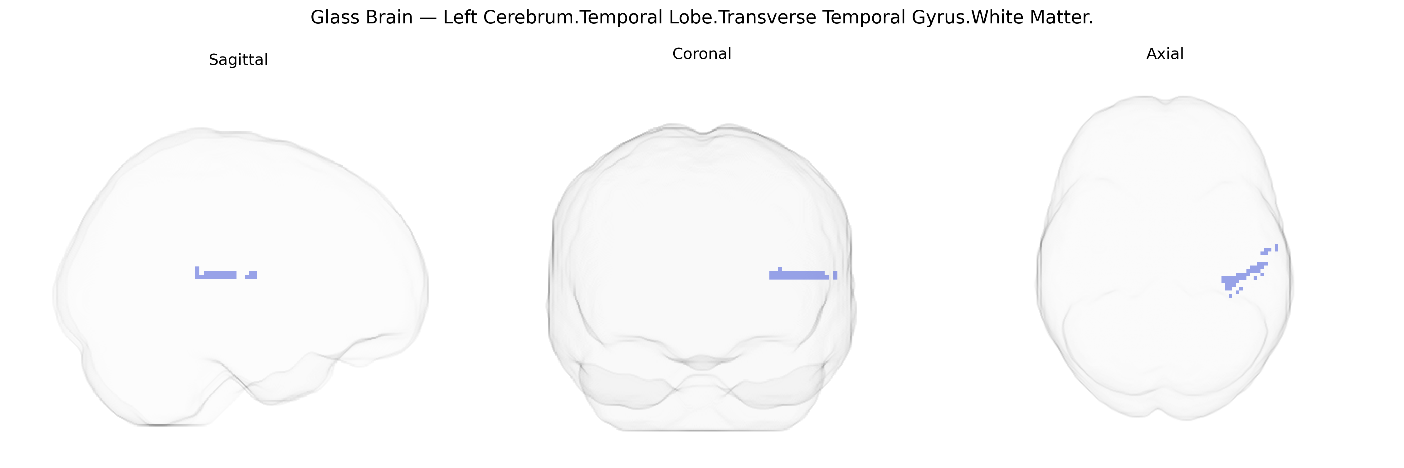 Triplanar Ghost Brain