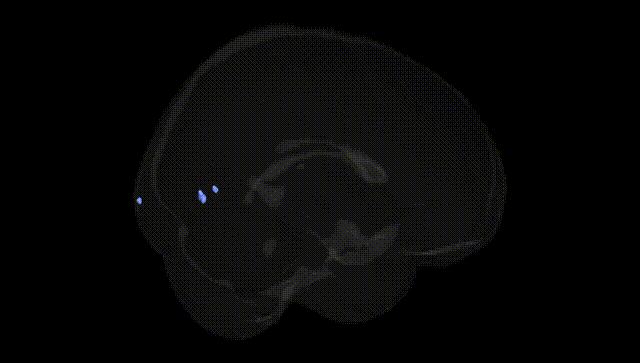Full Brain Black