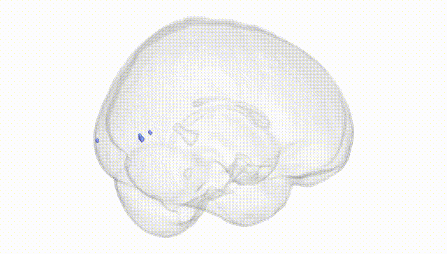 Full Brain White