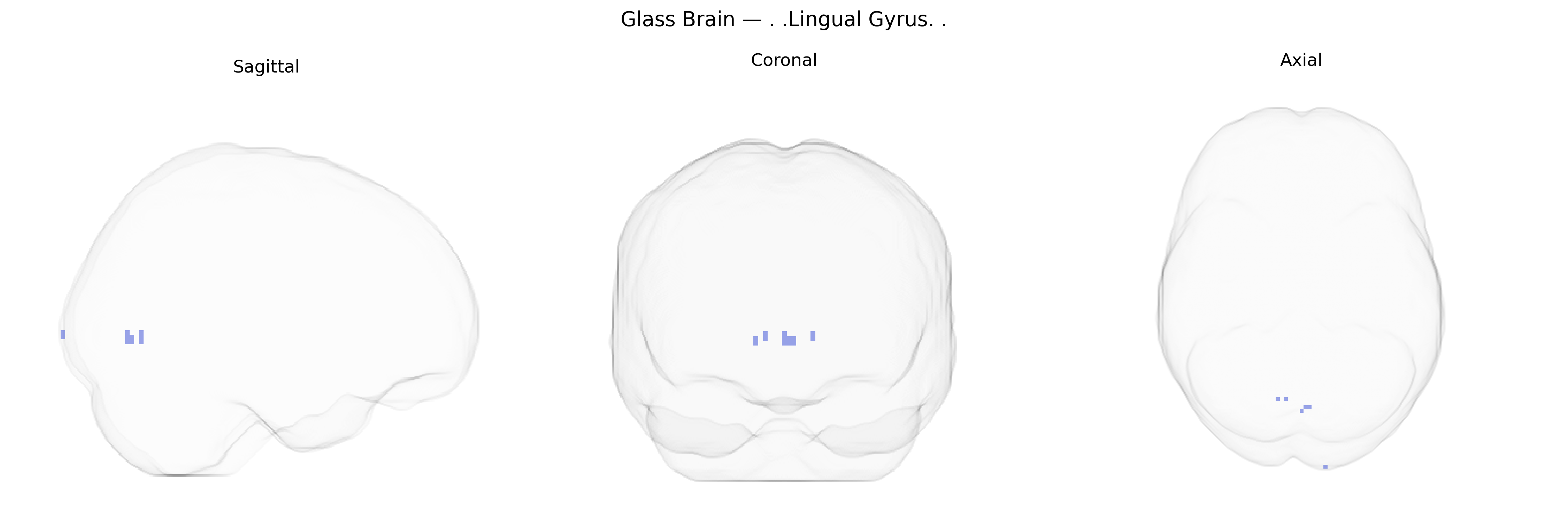 Triplanar Ghost Brain