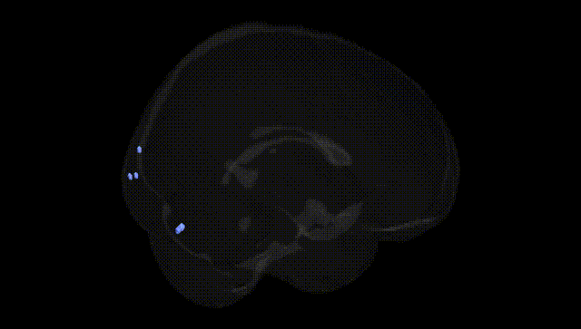 Full Brain Black
