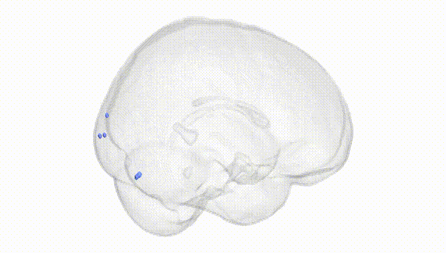 Full Brain White