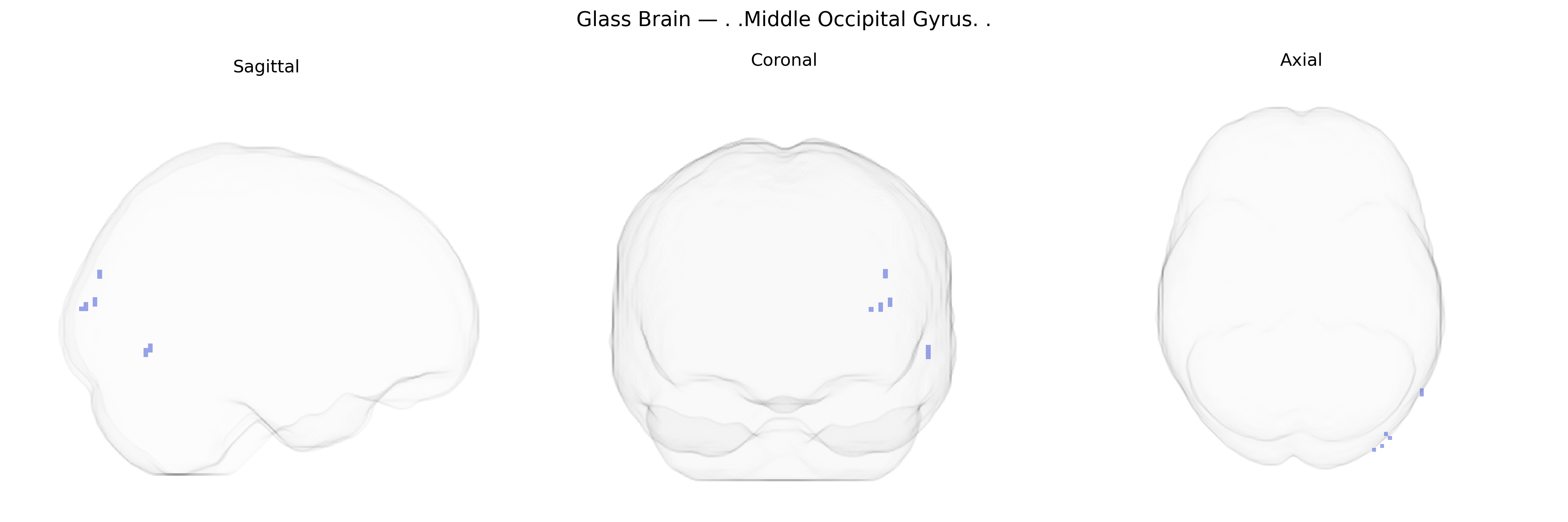 Triplanar Ghost Brain