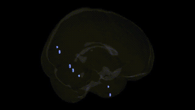 Full Brain Black