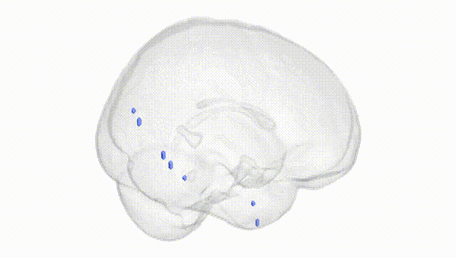 Full Brain White