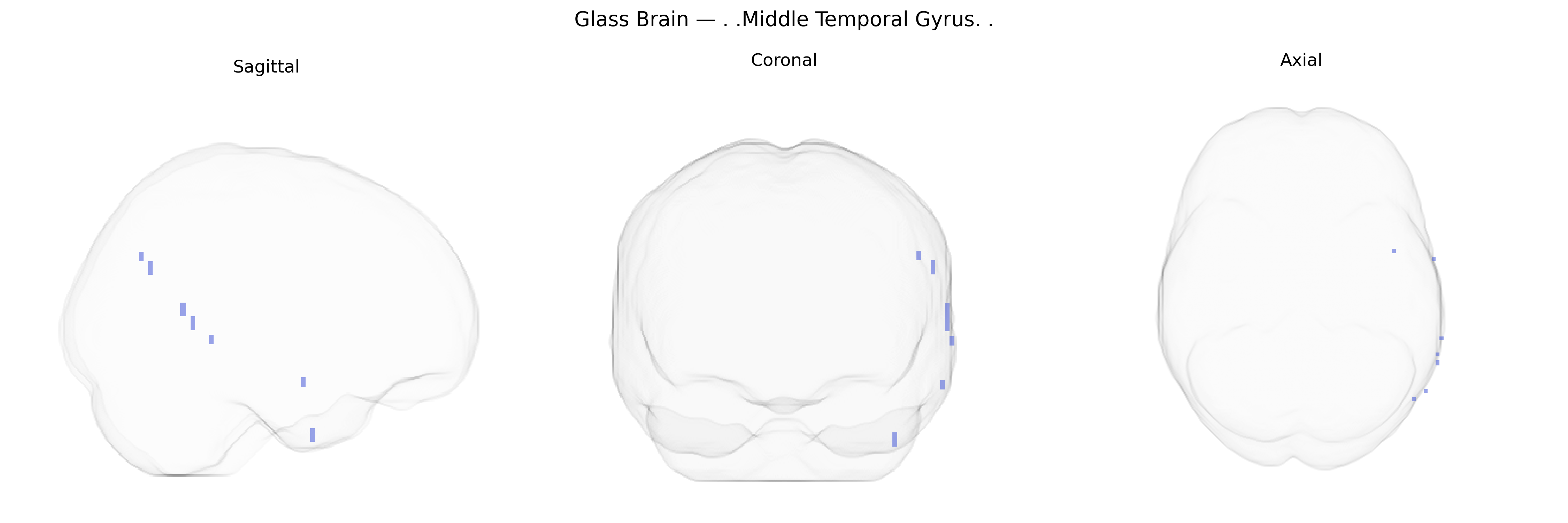 Triplanar Ghost Brain